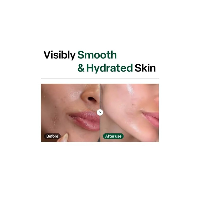 Dr.G- Cuidado peeling suave sin irritación de la piel.
