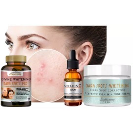 Crema blanca para blanquear la piel oscura suero ultra brillante manchas oscuras