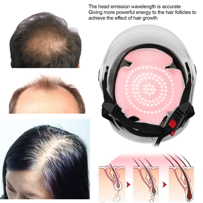 94pcs Lamp Beads Red Light Therapy Hair Loss Treatment Device