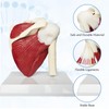 Human Shoulder Joint Model with Muscle Anatomical Model for Medical