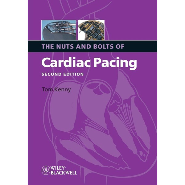 The Nuts and Bolts of Cardiac Pacing
