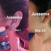 Jusse Anti Verrugas Lunares Mezquinos 15 Ml Sin Perfumar