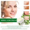 Tkekruh Face Cream (12)