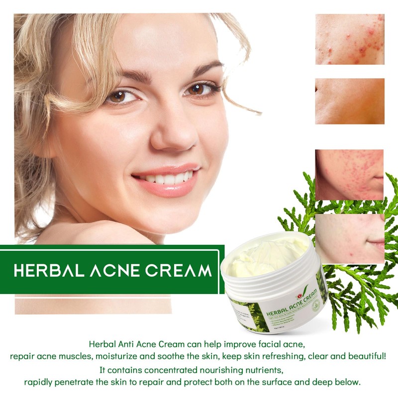 Tkekruh Face Cream (12)