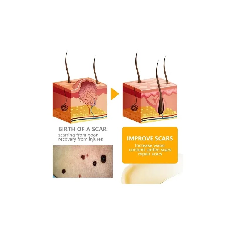 Crema Para El Cuidado De La Piel, Reduce Todo Tipo