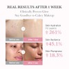 medicube PDRN Pink Collagen Bubble Serum | Bubble-to-Glow Firming Serum