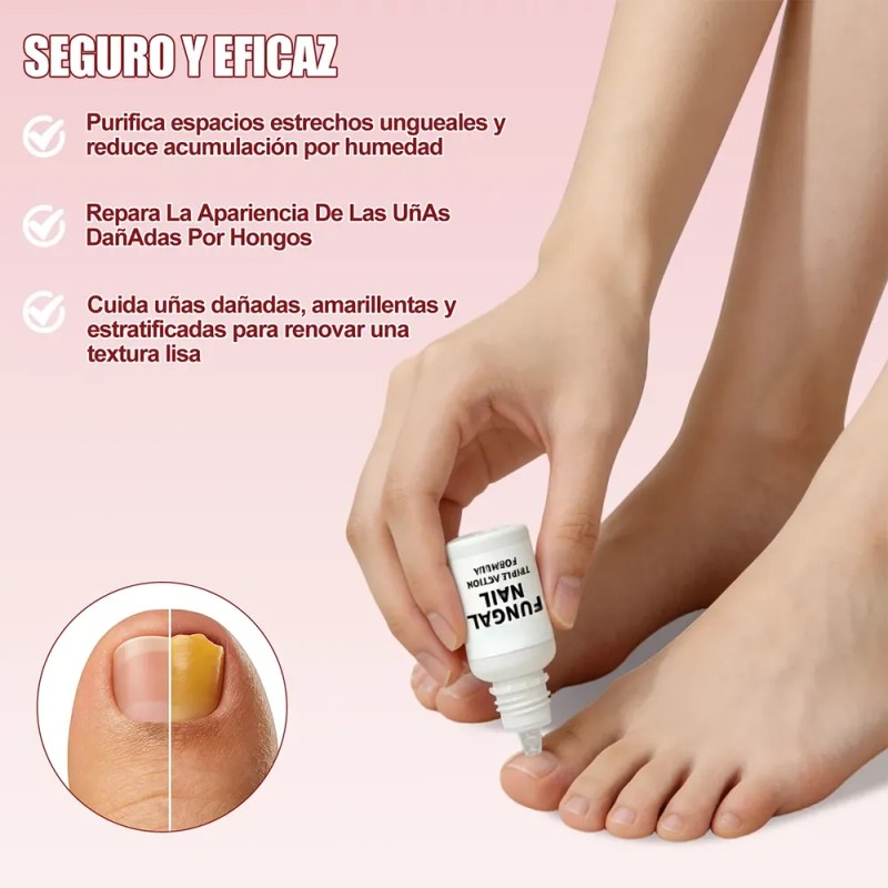 Tratamiento Para Uñas 15 Ml X2 Solución Para Cuidado De