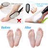 Foot File Callus Remover
