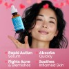 Seoulceuticals Suero Coreano Para El Acné, Tratamiento Para
