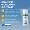 NIVEA Cellular Luminous 630 Verbesserungsserum für Akne-Farbversion, 30 ml