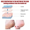 5 Pieces Exfoliating Foot Peel Mask Hydrating Moisturizing Smoothing for