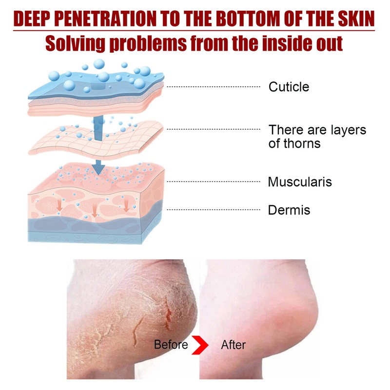 5 Pieces Exfoliating Foot Peel Mask Hydrating Moisturizing Smoothing for