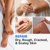 Strawberry Skin Treatment Cream, 118g Exfoliating Moisturizing Lotion for Bumpy