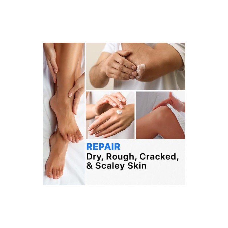Strawberry Skin Treatment Cream, 118g Exfoliating Moisturizing Lotion for Bumpy