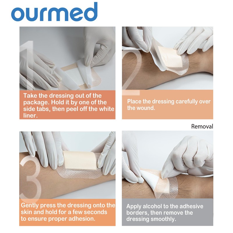 Ourmed Soft Flex Silicone Foam Dressings(6"x 6", Pack of 10)