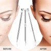 USCOLOR Pimple Remover Tool Kit Blackhead Extractor Comedone Acne Spot