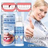EELHOE 1/2/4pcs EELHOE Moldable Dental Gel Dentures Temporary Fillings Cavities