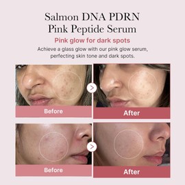 MEDICUBE [MEDICUBE]Collagen PDRN Pink Peptide Serum Duo