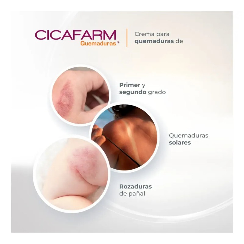 Crema Cicatrizante Para Quemaduras Superficiales Cicafarm Q