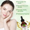 Aceite Monarda Antibacteriano Piel Cuidado Cabello, Antiedad Monarda