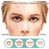 396Pcs Blemish Patches Facial Pimple Zit Spot Stickers Mild Non