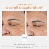 NEOSTRATA Illuminating Serum Tone Correcting Concentrate with NeoGlucosamine Niacinamide and