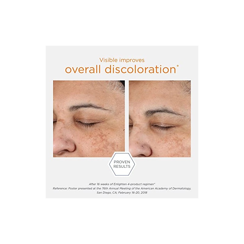 NEOSTRATA Illuminating Serum Tone Correcting Concentrate with NeoGlucosamine Niacinamide and