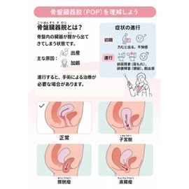 Pikasatsu Pelvic Floor Supporter, Medical Use, Made in Japan, Urine Leakage, Pelvic Organ Removal, Genital Devastation, Countermeasure, Support Shorts, Non-stuffy, Breathable, Black, M (Hip: 34.3 - 37.4 inches (87 - 95 cm)