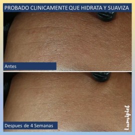 Roc Line Smoothing Max Hydration Crema Hidratante Sf 48g                                                                                              