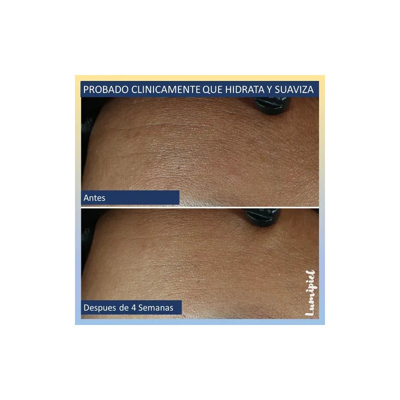 Roc Line Smoothing Max Hydration Crema Hidratante Sf 48g