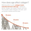 Youtheory Collagen with Vitamin C, Advanced Hydrolyzed Formula for Optimal