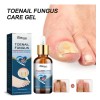 Mi Gel Para El Cuidado De Los Pies, Una Vida,