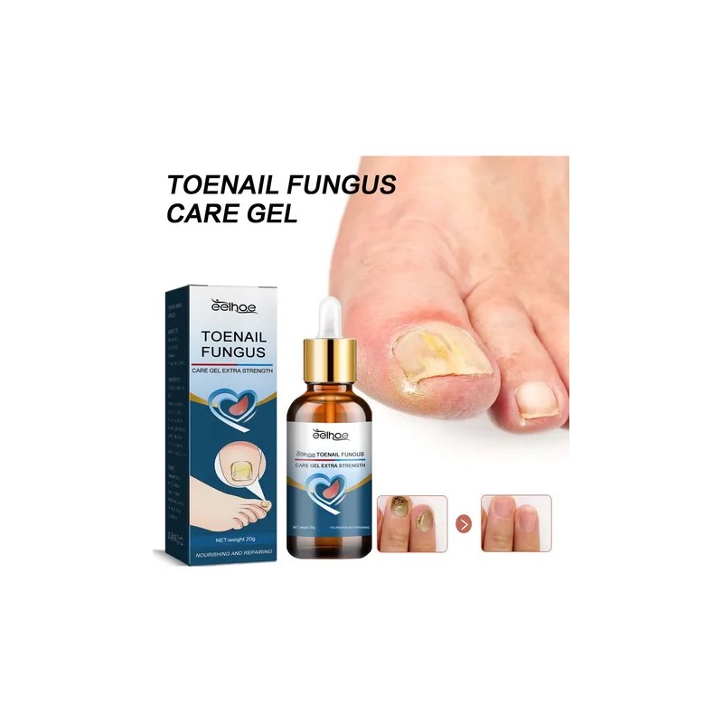 Mi Gel Para El Cuidado De Los Pies, Una Vida,