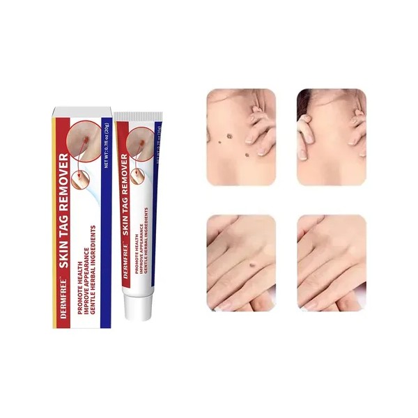 Crema Para Verrugas Spointts Antiverrugas Anti-vph