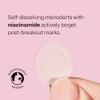 Peach Slices Dark Spot Micro Dardos | Para puntos oscuros,