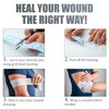 Dressing Retention Tape - 2" x 11yd, 2 Rolls Premium