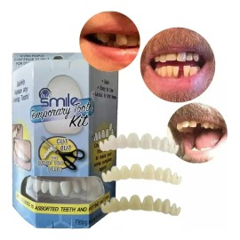 Dientes Postizos Temporal Falsos Reparación Rellenar