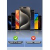 ZXZone Metal Phone Tether Tab, Anti-Scratch, Metal Phone Patch, Universal