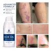 Murasaki Beauty Gel Cicatrizante De Silicona Para Cicatrices Viejas Y