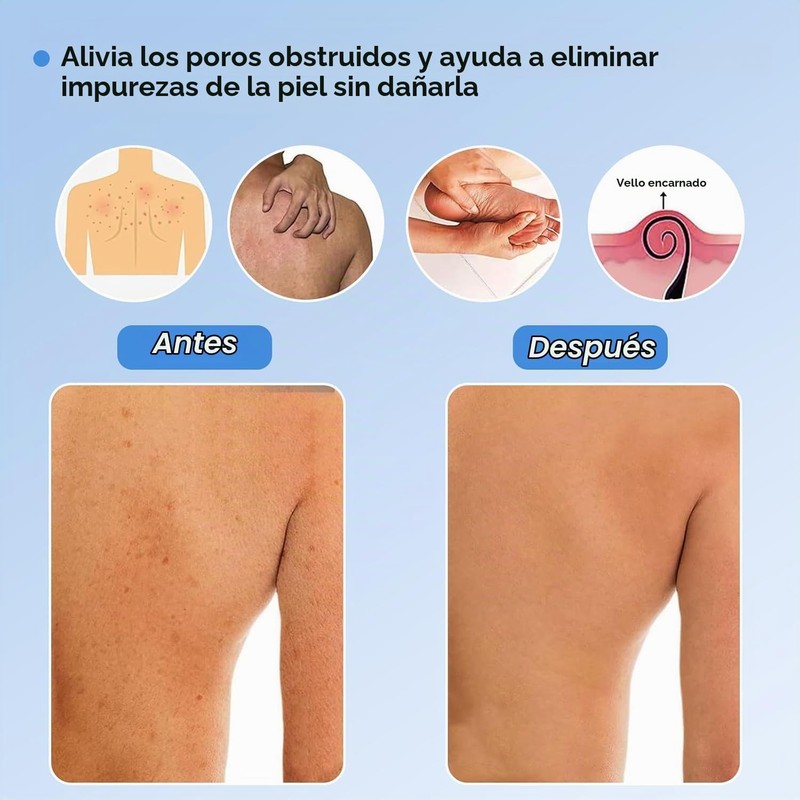 Guantes Exfoliantes para Baño Negros 5 Pcs LBYHZS Hammam y