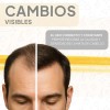 Shampoo Anticaída Crecimiento Capilar Cabello Con 3 Activos
