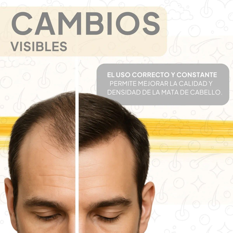 Shampoo Anticaída Crecimiento Capilar Cabello Con 3 Activos