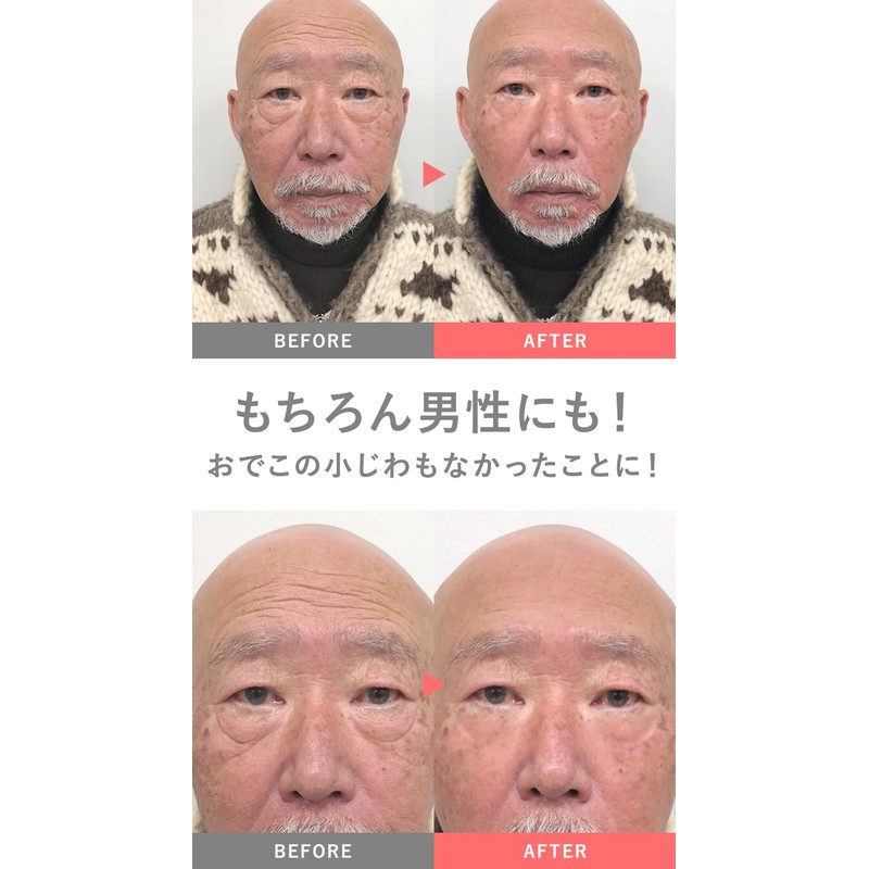 MIRACOCO (ミラココ) 【公式】 リンクルール 15g ｜クリーム 顔 目元ケア 目元クリーム おでこ