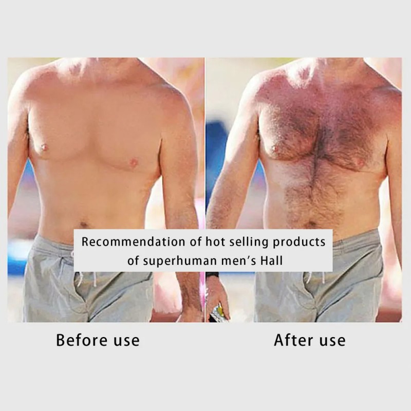 Aceite For El Crecimiento De La Barba O0 Suero For