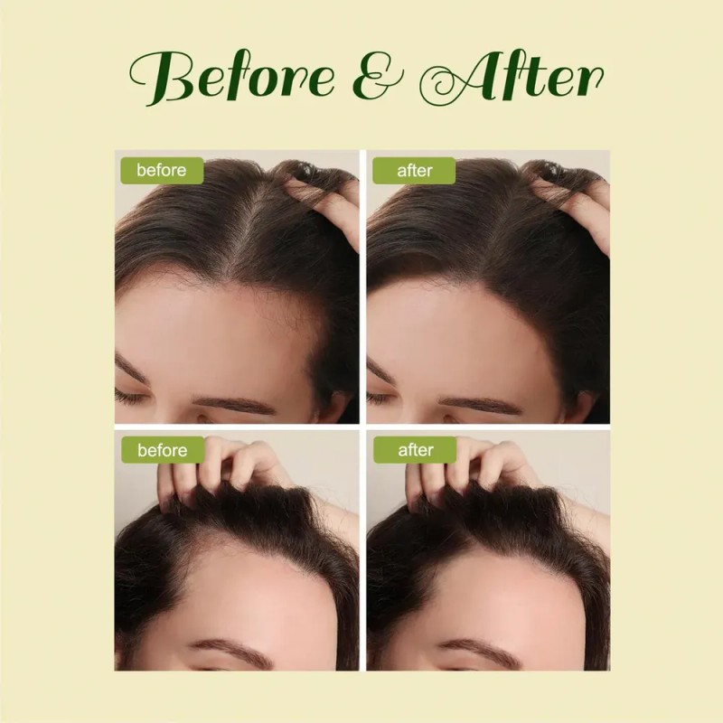 Aceite Para El Crecimiento Del Cabello Feibth Veganic Natura