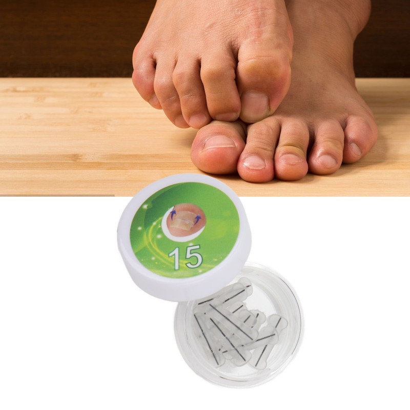 10pcs Toenail Correction Strips Brace Elastic Change Growth Direction Ingrown
