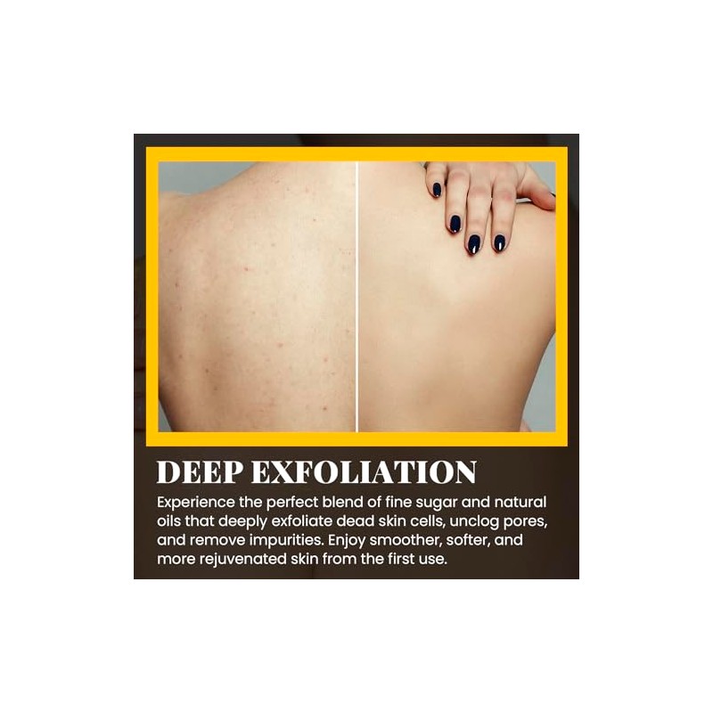 "Chillihaer "Exfoliante de cúrcuma CHILLIHAER para eliminar las axilas oscuras,