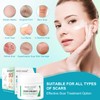 Scar Cream, Scar Ointment, Stretch Mark Cream, Scar Remove Cream