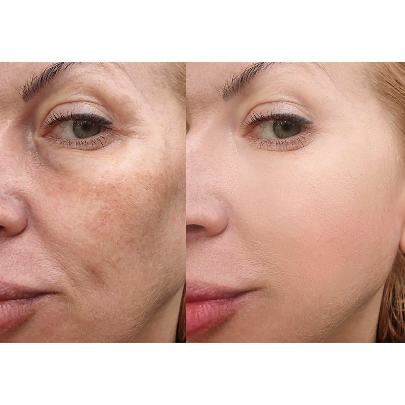 Vitality Precision Skin Micro-Exfoliating Scrub