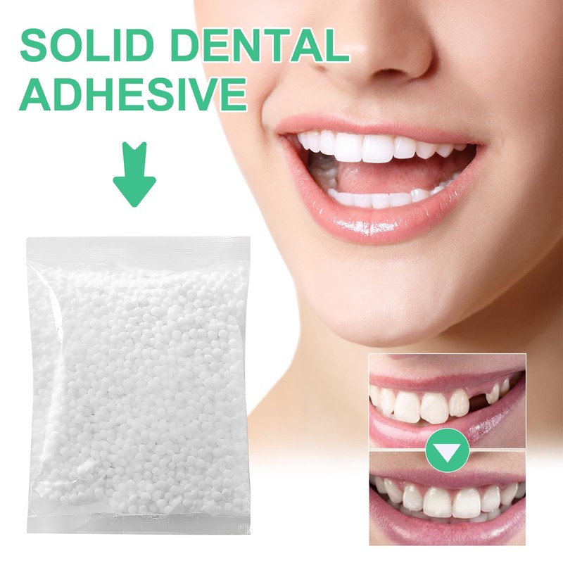 Temporary Tooth Repair Kit – Moldable False Teeth Beads for